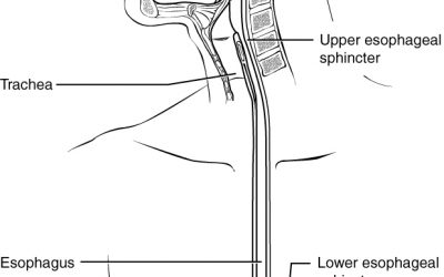 What Is Eosinophilic Esophagitis?